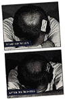 [Bald]