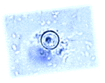 [Cyclospora]