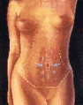 [Tummy1]